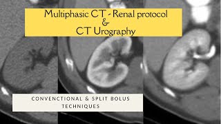 MULTIPHASIC RENAL CECT PROTOCOL  SPLIT BOLUS TECHNIQUE CT UROGRAPHY Triple bolus technique [upl. by Ynatirb]