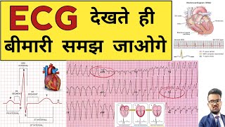 ECG Report  ECG Report Reading  ECG Report kaise Pade  Doctor  Hospital  Nursing  BHMS  BAMS [upl. by Eiryk795]