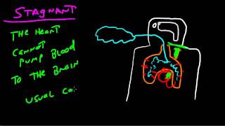 The Four Types Of Hypoxia [upl. by Guthrie]