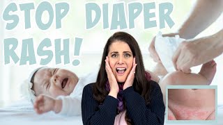 DIAPER RASH Top Tips to Prevent amp Treat Common Diaper Rashes [upl. by Drexler]