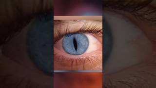 Do you also have these eye diseaseshortsknowledge [upl. by Arsi]