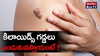 Skin Keloid  Keloid Scar Causes and Treatment  DrRajasekhar Madala MedPlusONETV [upl. by Ydnew420]