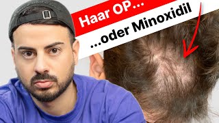 Haartransplantation oder Minoxidil  Raul verliert weniger als 100 Haare am Tag [upl. by Lukin]