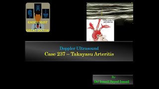 Ultrasound Case 237  Takayasu Arteritis [upl. by Atinar]