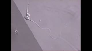 Sperm swimming in microscope field [upl. by Oigres942]