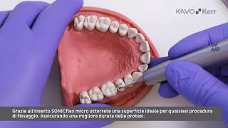 Inserti SONICflex micro – caso clinico [upl. by Neelrahc]