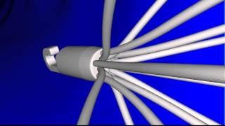 Simulation of Inferior Vena Cava IVC Filter Deployment and Blood Flow in a PatientSpecific Model [upl. by Jan430]