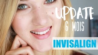 Update INVISALIGN  6ème mois [upl. by Anifur]