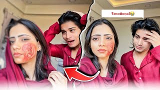 Face burning prank on boyfriend 😡 prank gone wrong 😭 adnan rone lage 😑 [upl. by Ateuqirne]