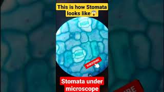 stomata under microscope [upl. by Arhoz]