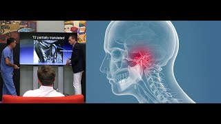 The SECRET to Diagnosing a TMJ Problem [upl. by Ku]