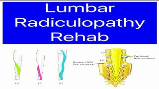 Lumbar Spine Rehab Radiculopathy Sciatica Lumbar Nerve Root Compression LOWER BACK and LEG PAIN [upl. by Michail635]