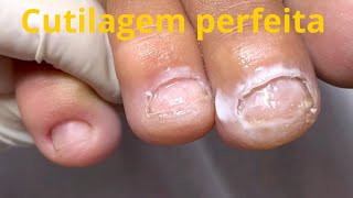 Veja o que eu precisei fazer para deixar a cutícula perfeita não perca esse vídeo 🙈 [upl. by Eladnor]