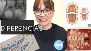 Diferencias entre Dentición temporal y permanente [upl. by Ecirtemed]