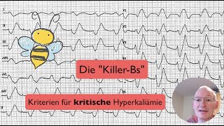 EKGQuickie Achtung bei KillerBs 🐝 oder Gefährliche Hyperkaliämie rasch im EKG erkennen [upl. by Dreeda]