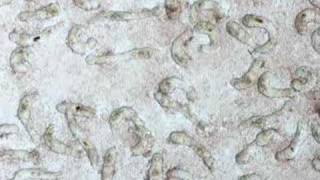 Schistosoma mansoni larvae cultured for 6 days [upl. by Yleve]