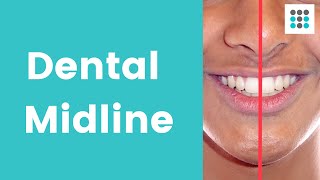 DENTAL MIDLINE SHIFT What why and how to correct l Dr Melissa Bailey [upl. by Nitaj83]