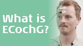 What is the Electrocochleography ECochG Test [upl. by Ylrevaw188]