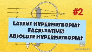 HYPERMETROPIA  What is latent hypermetropia  manifest hypermetropia facultative hypermetropia [upl. by Llenahs]