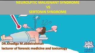 Neuroleptic malignant syndrome vs Sertonin syndrome Hyperthermia [upl. by Olinad]