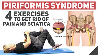 Piriformis Syndrome  Home Stretches amp Exercises [upl. by Lohrman]