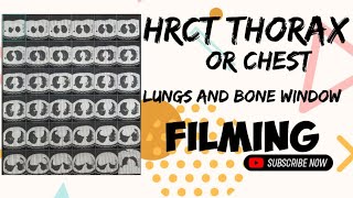 😮‍💨HOW TO DO HRCT THORAXCHEST FILMING PROCESS  LUNGS AND BONE WINDOW FILMING🎞 [upl. by Labotsirhc742]