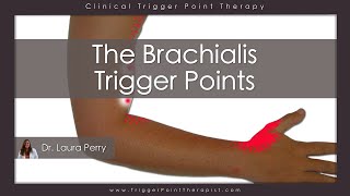 The Brachialis Trigger Points [upl. by Iraj]