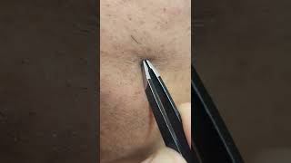 Tweezing Stubborn Facial Hairs Extraction Tweezers [upl. by Hsinam361]