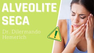 ALVEOLITE SECA  O que é [upl. by Babita]