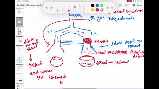 coronary steal syndrome cardiology 83  First Aid USMLE Step 1 in UrduHindi [upl. by Panther844]