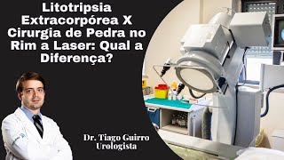 Litotripsia Extracorpórea X Cirurgia de Pedra no Rins a Laser Qual a Diferença [upl. by Eelime]