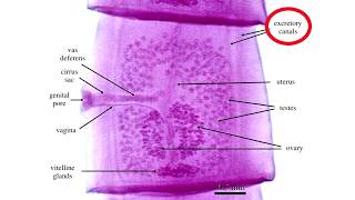 Diphyllobothrium Latum [upl. by Adkins]