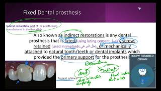 Introduction to Fixed Prosthodontics [upl. by Emili]