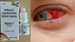 Moxicin  LP  Moxifloxacin LP  Uses  Bacterial infection  Optometry solution [upl. by Nonnahsed460]