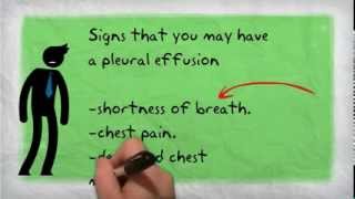 Pleural Effusion [upl. by Sontag]