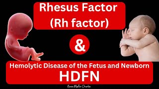 Rhesus Disease and HDFN [upl. by Anaej]