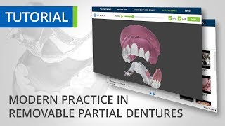 Animated Removable Partial Dentures  Apollo Medical Travel [upl. by Henebry]