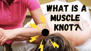 What is a MUSCLE KNOT and how it is FORMED [upl. by Netsoj199]