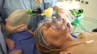 Intubation orotrachéale IOT  bases anatomiques et technique de réalisation [upl. by Nohtan3]