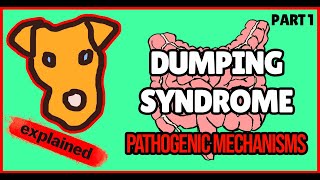 Dumping syndrome Part 1 Definition Physiology General concepts [upl. by Weasner]