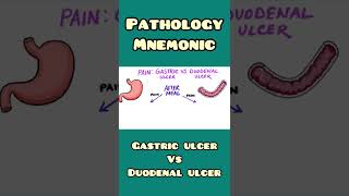 Gastric Ulcer vs Duodenal Ulcer  mnemonic  Pathology Surgery  shorts [upl. by Dasteel]