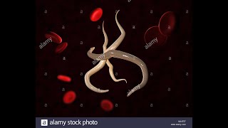 Nématodes transcutanés anguillulose strongyloide stercoraris 3 eme année médecine résumé des cours [upl. by Ahsiri345]