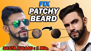 How to FIX PATCHY BEARD  Hide Beard Patches  Beard Tips  Beard Growth Natural Tips  Shorts [upl. by Darline]