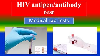 HIV antigenantibody test  Medical Lab Tests  What is   Uses  Need  Preparation  Results [upl. by Molini]