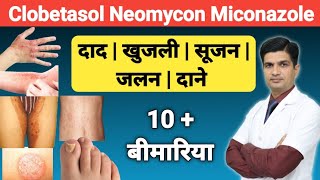 दाद खुजली को ठीक करने की क्रीम । Clobetasol Neomycin and Miconazole cream [upl. by Aneehc]