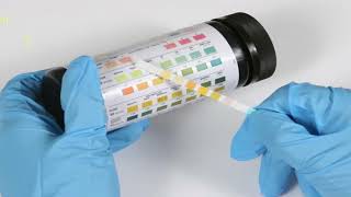 Urine Dipstick assay for proteinuria  Important Points for MDDM residents [upl. by Raffaello]