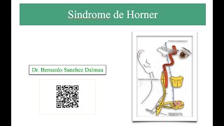 Síndrome de Horner [upl. by Euqinay]