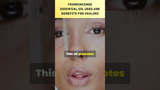 Frankincense Essential Oil Uses and Benefits for Healing [upl. by Chelsy982]