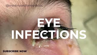 eye infections I MICROBIOLOGY I SECOND YEAR MBBSI USMLE I NEXT [upl. by Doris]