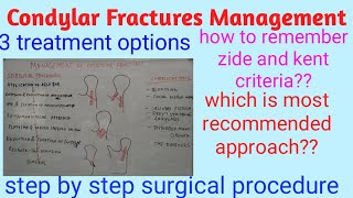 Condylar fractures management [upl. by Catie781]